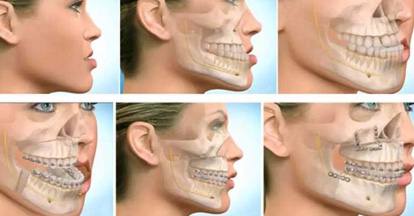 تخصص جراحی فک و صورت