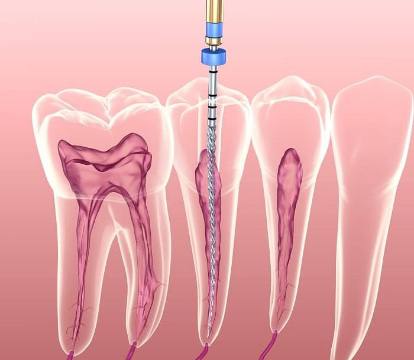 تخصص درمان و ریشه
